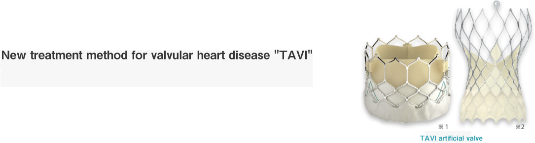 New treatment method for valvular heart disease &quot;TAVI&quot;
